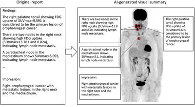 A Preliminary Study to Use SUVmax of FDG PET-CT as an Identifier of Lesion for Artificial Intelligence